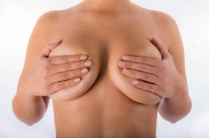 Breast Implant Revision in Miami