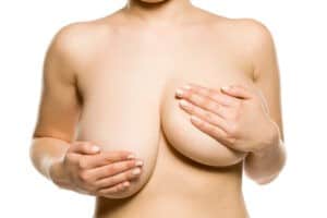 Uneven breasts Miami surgeon